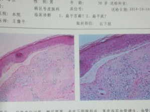 超越恐惧，勇往直前（揭秘面对恐惧的7大攻略，帮你走出阴霾）